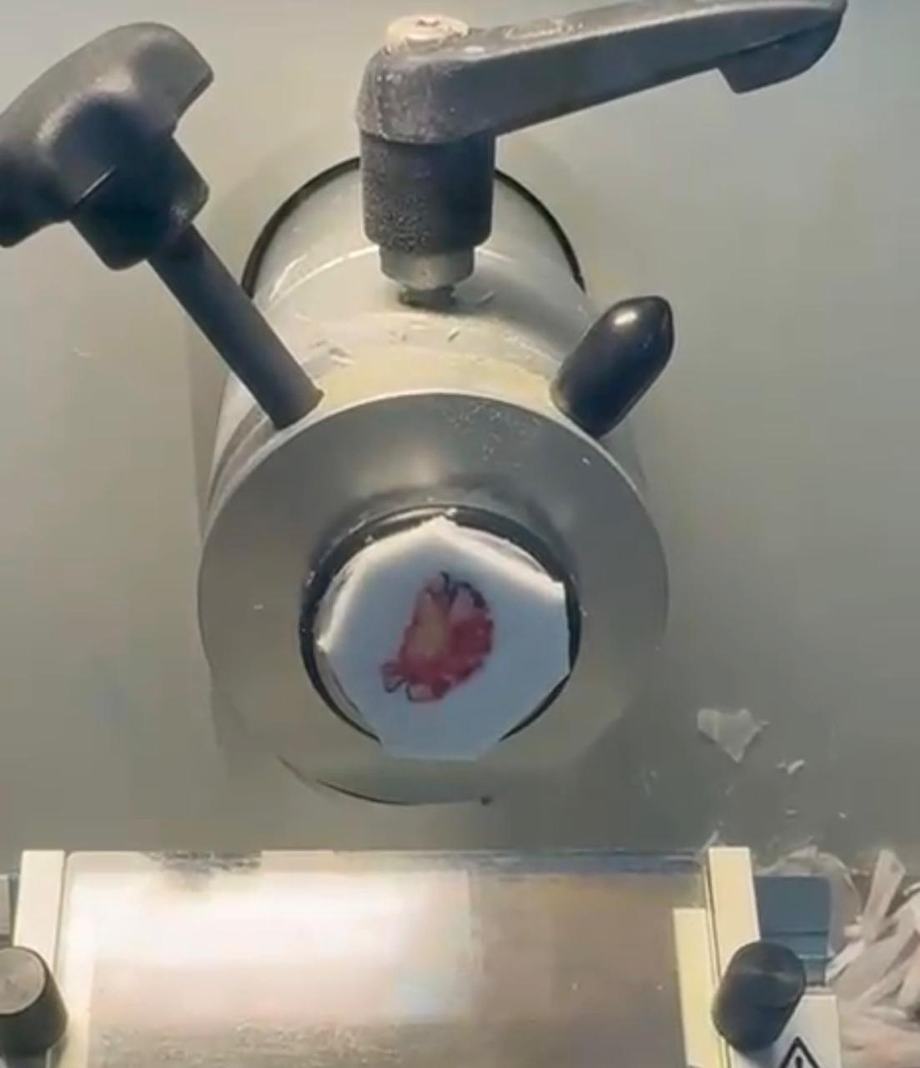 Peça cirúrgica de câncer de pele fixada no criostato, sendo cortada em lâminas finas para a análise das margens durante a Cirurgia de Mohs